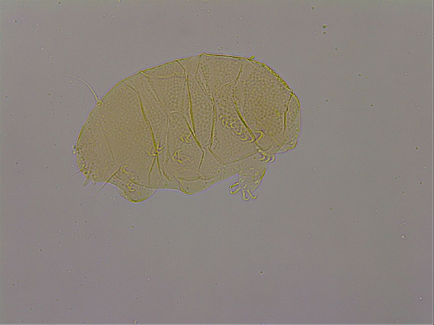 Echiniscus nigripustulus image