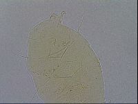 Echiniscus spiniger image