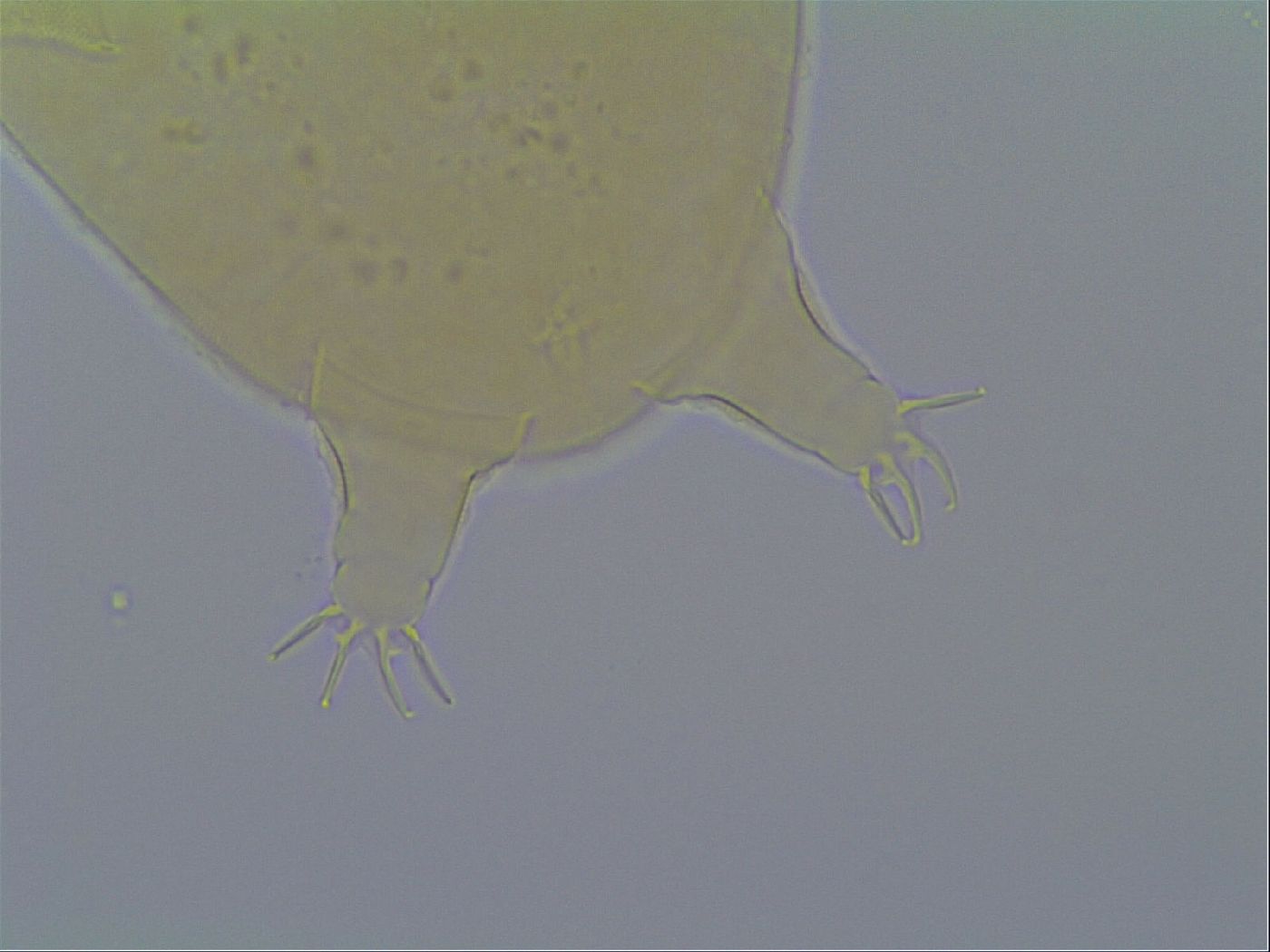 Hypechiniscus exarmatus image