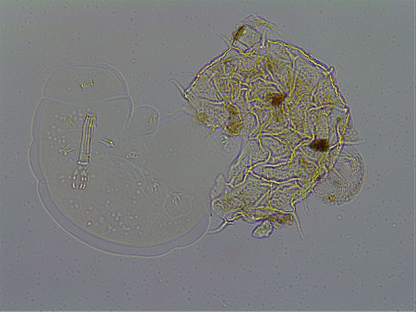 Macrobiotus psephus image