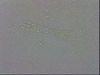Mesobiotus coronatus image