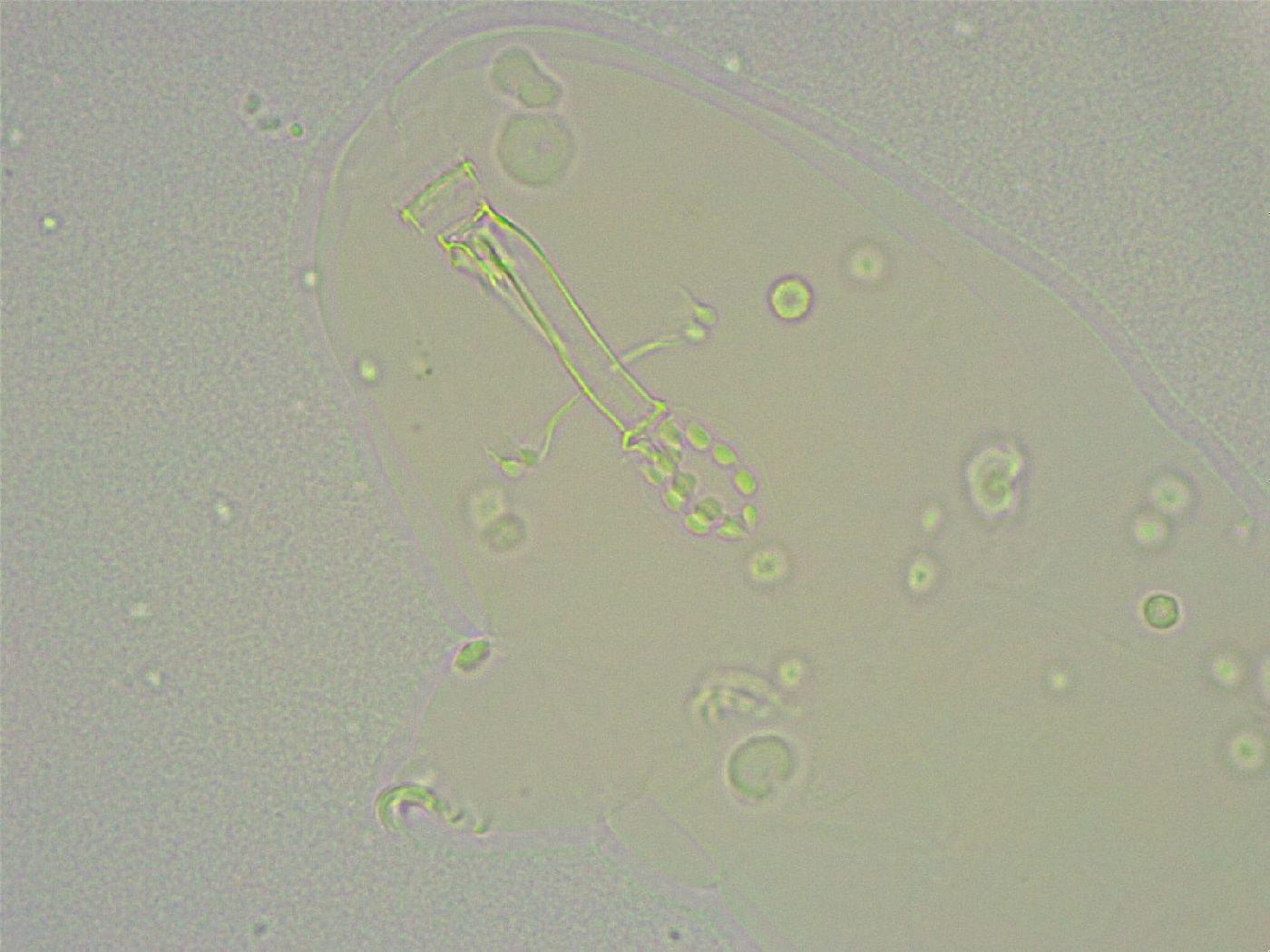 Mesobiotus liviae image