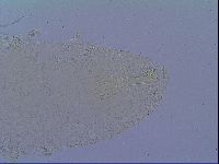Mesobiotus snaresensis image