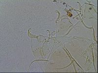 Echiniscus testudo image