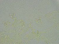 Pseudechiniscus ramazzottii image