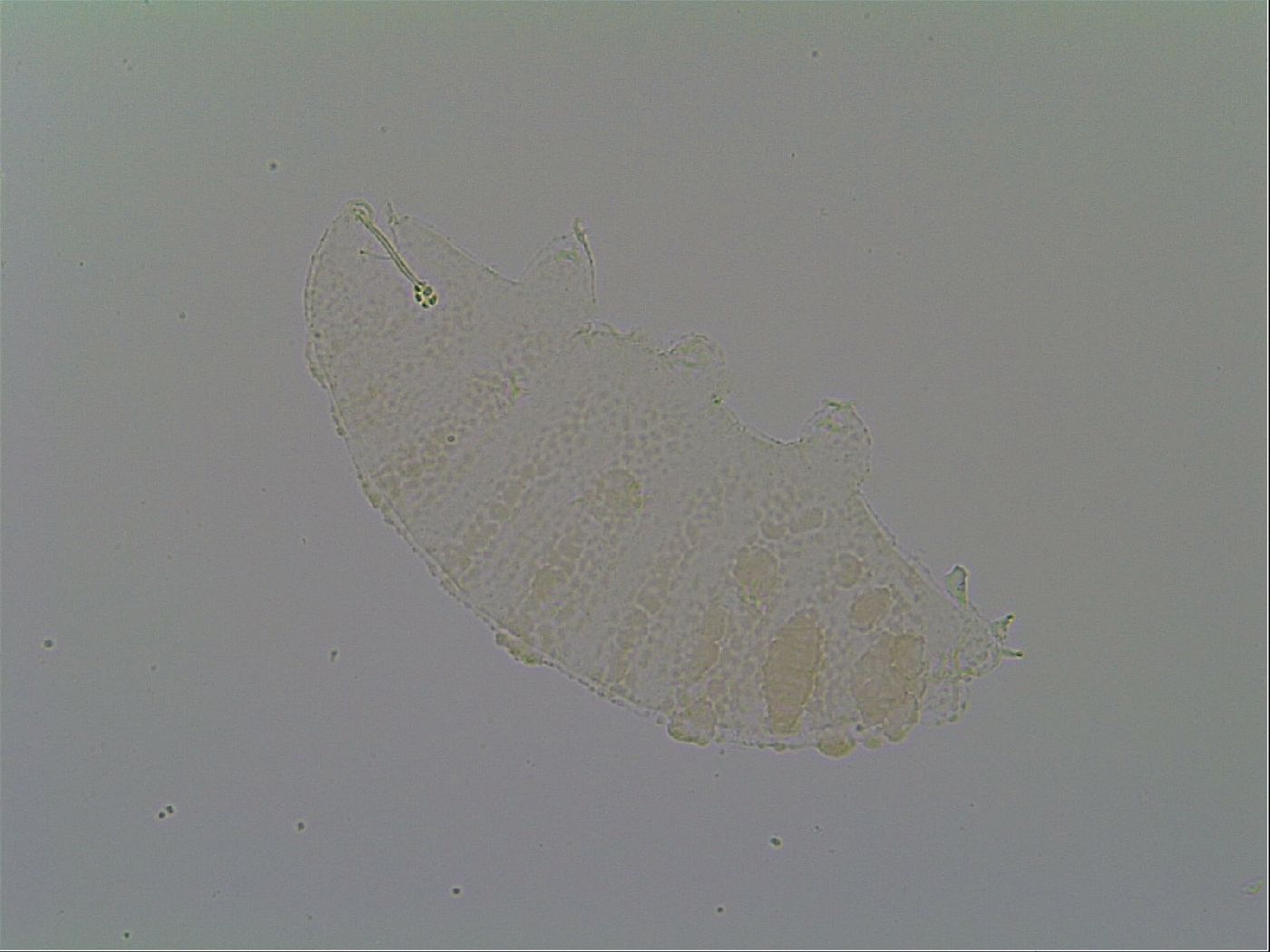 Calohypsibius placophorus image