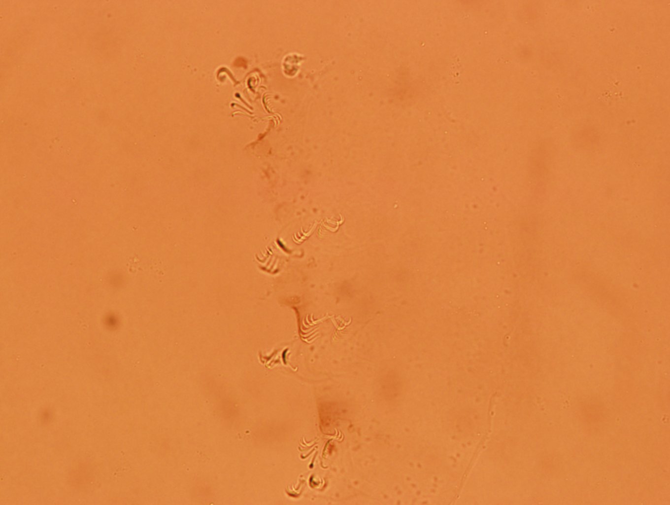 Echiniscoididae image