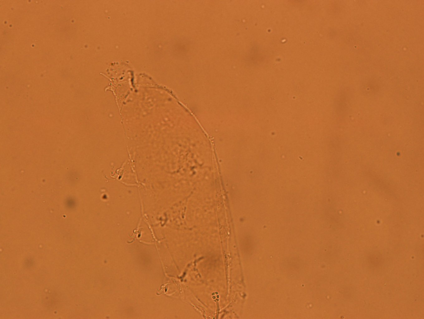 Hypsibius calcaratus image