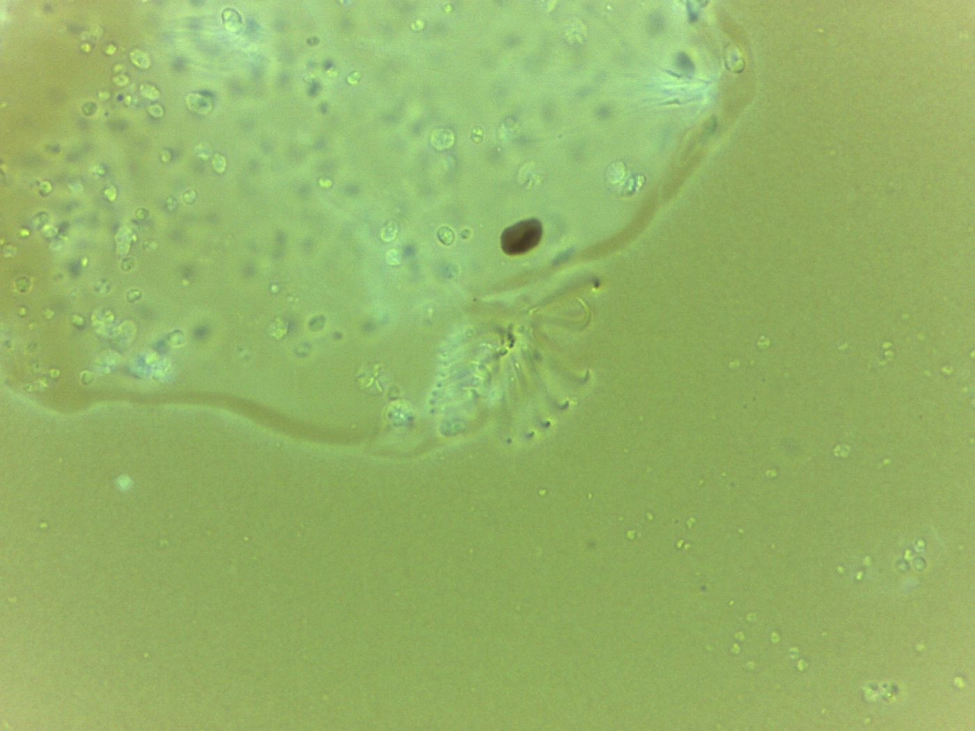Echiniscoides image