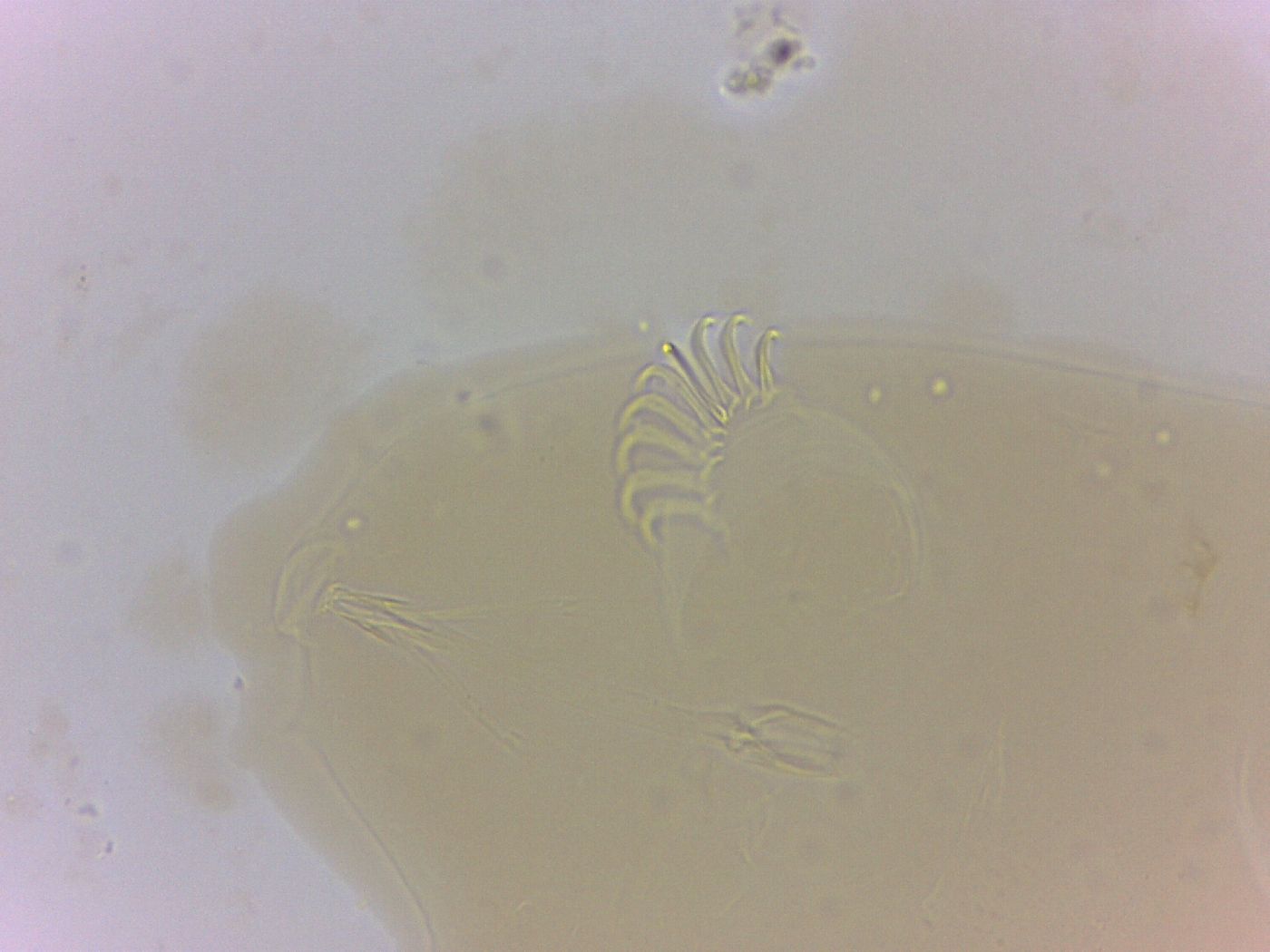Echiniscoides sigismundi image
