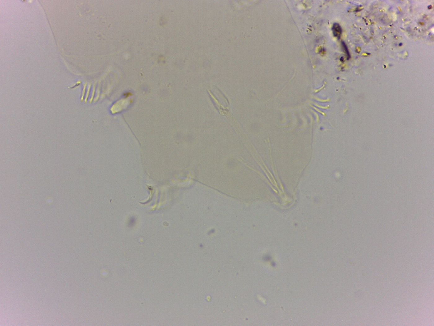 Echiniscoides image