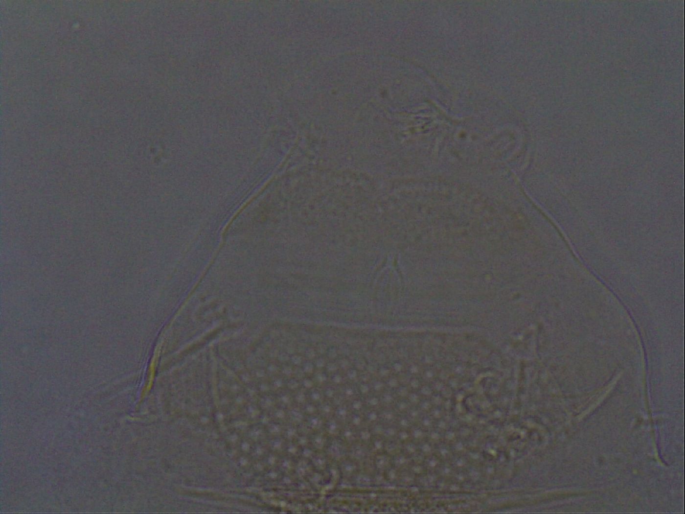 Echiniscus africanus image