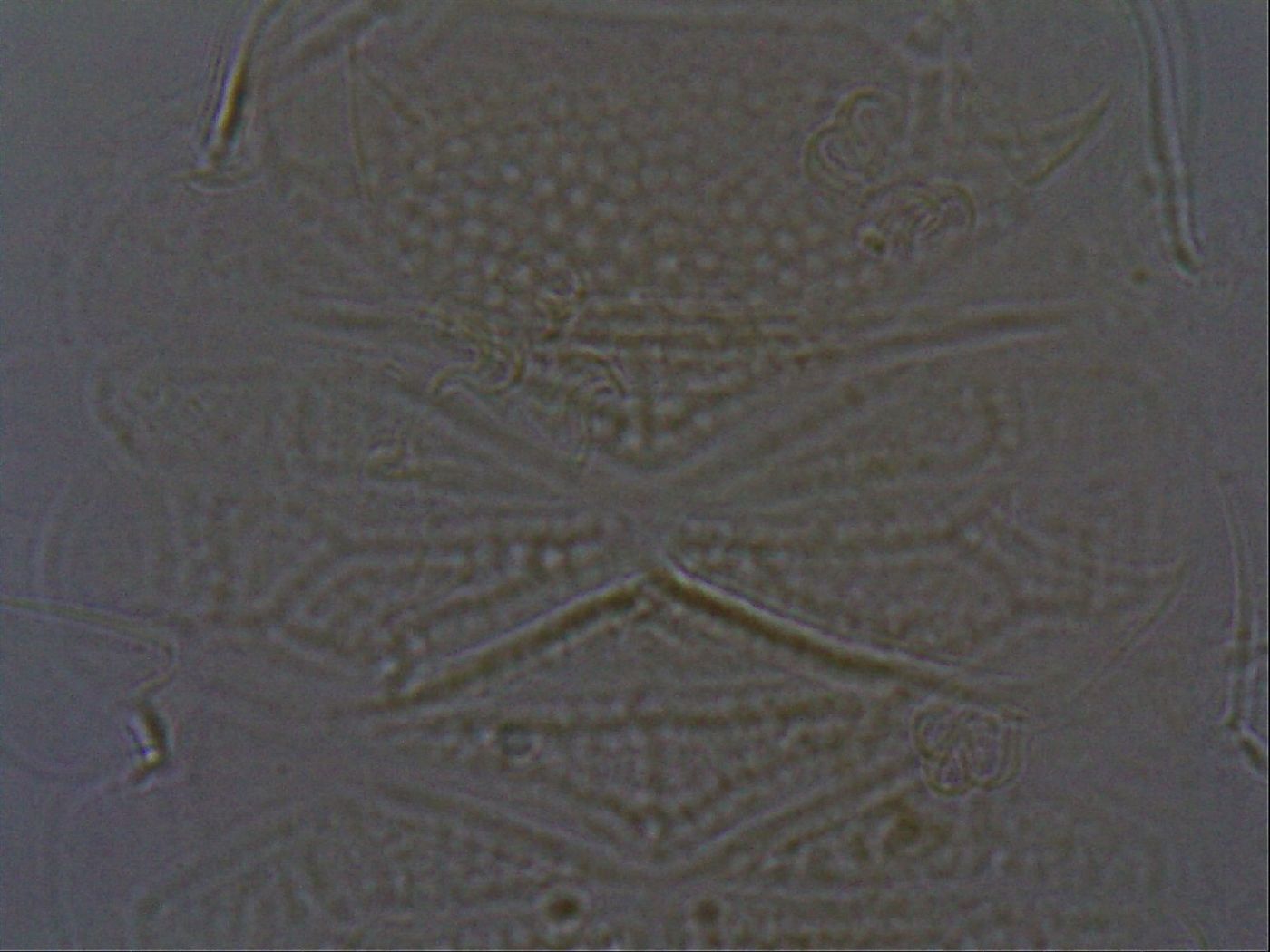 Echiniscus africanus image