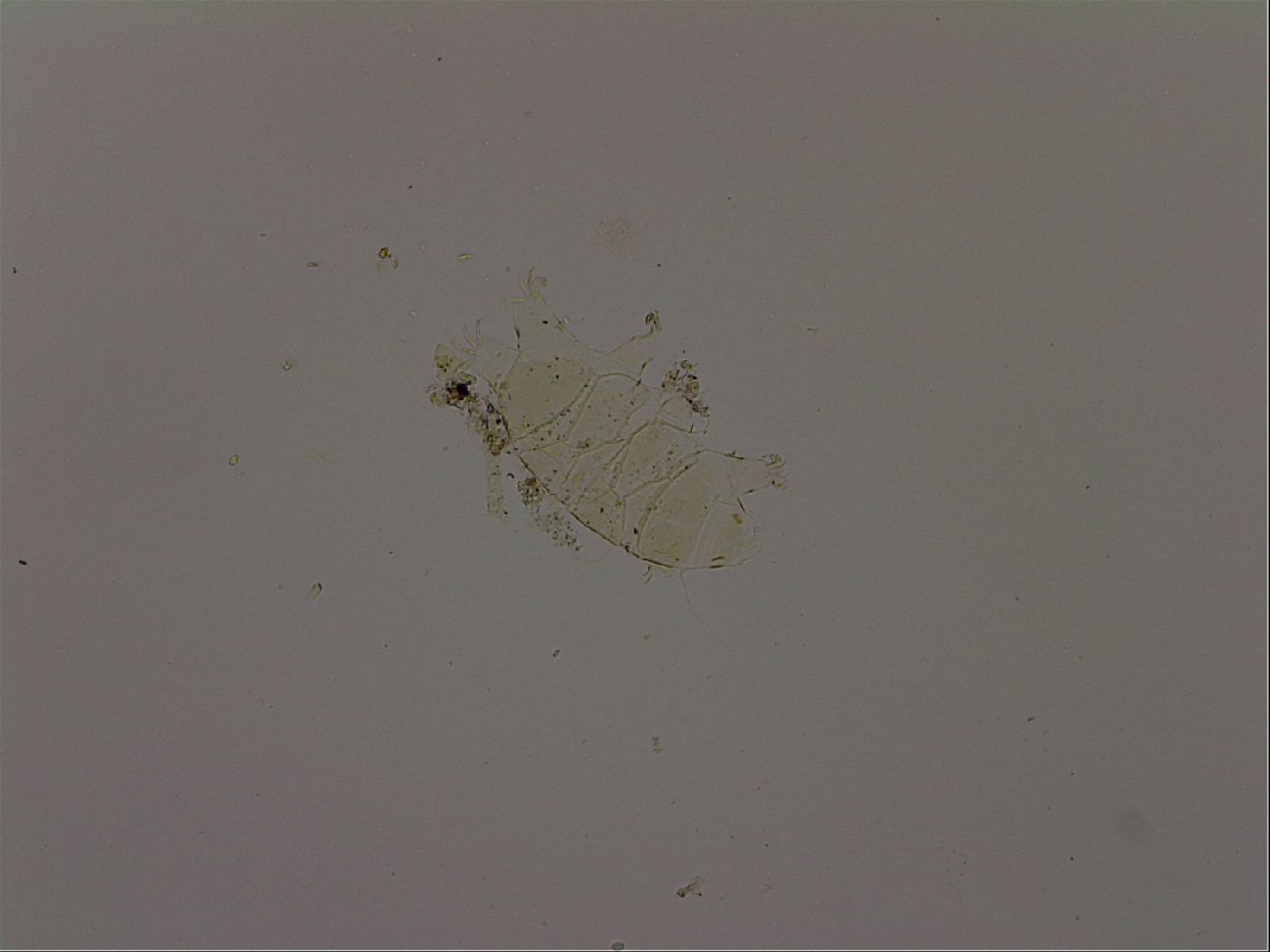 Echiniscus becki image