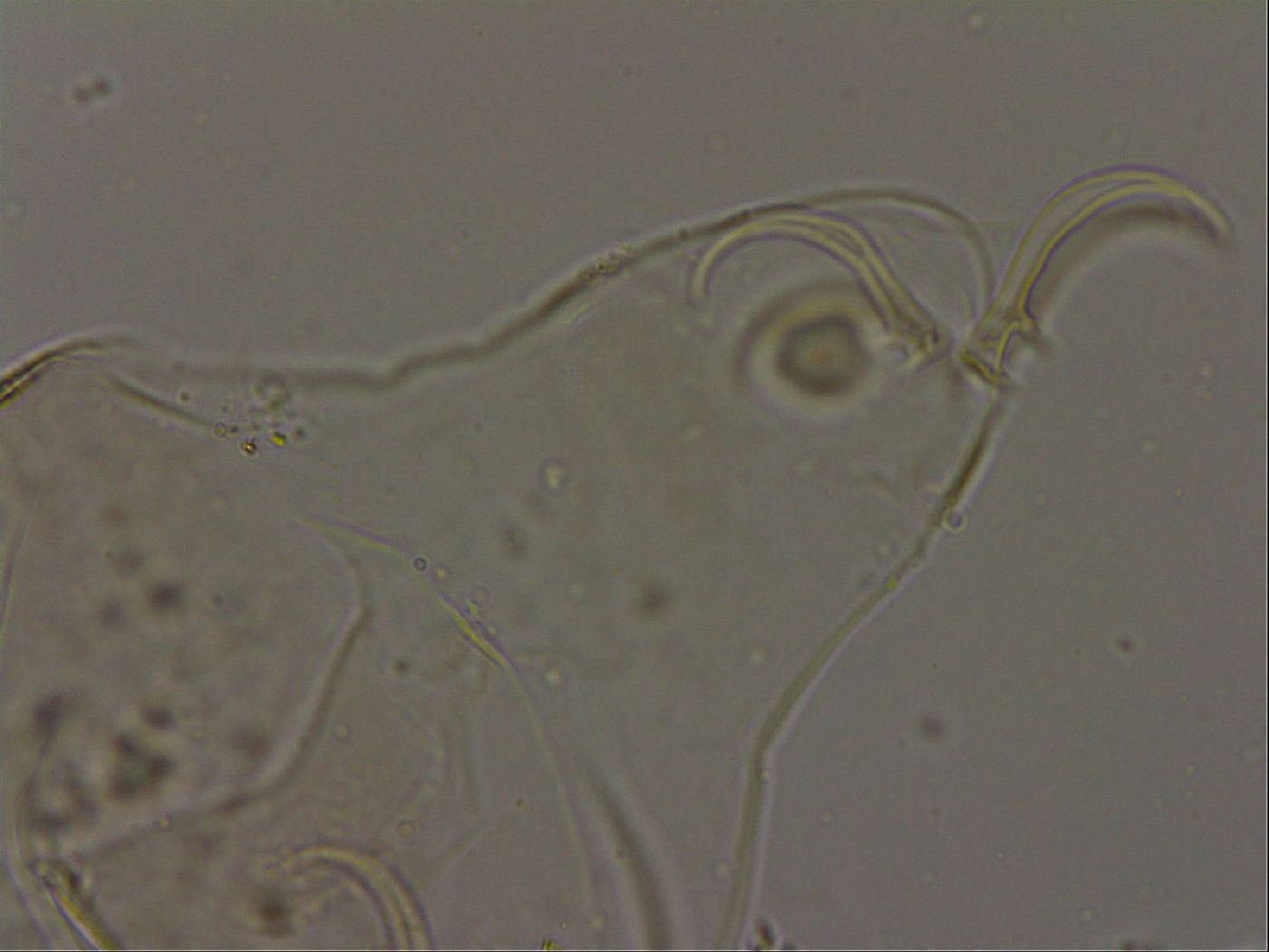 Echiniscus becki image