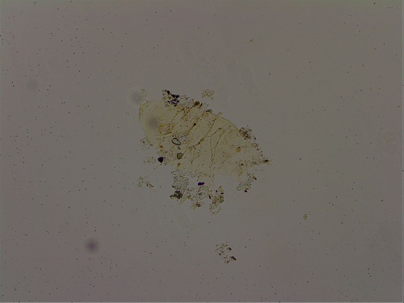 Echiniscus becki image