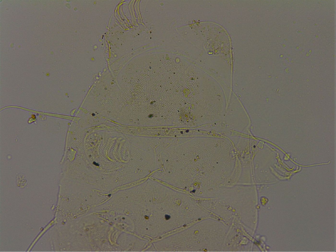 Echiniscus becki image