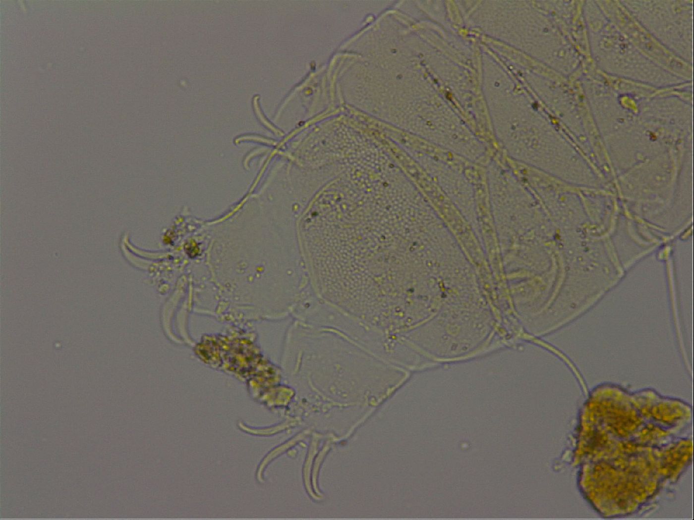 Echiniscus becki image