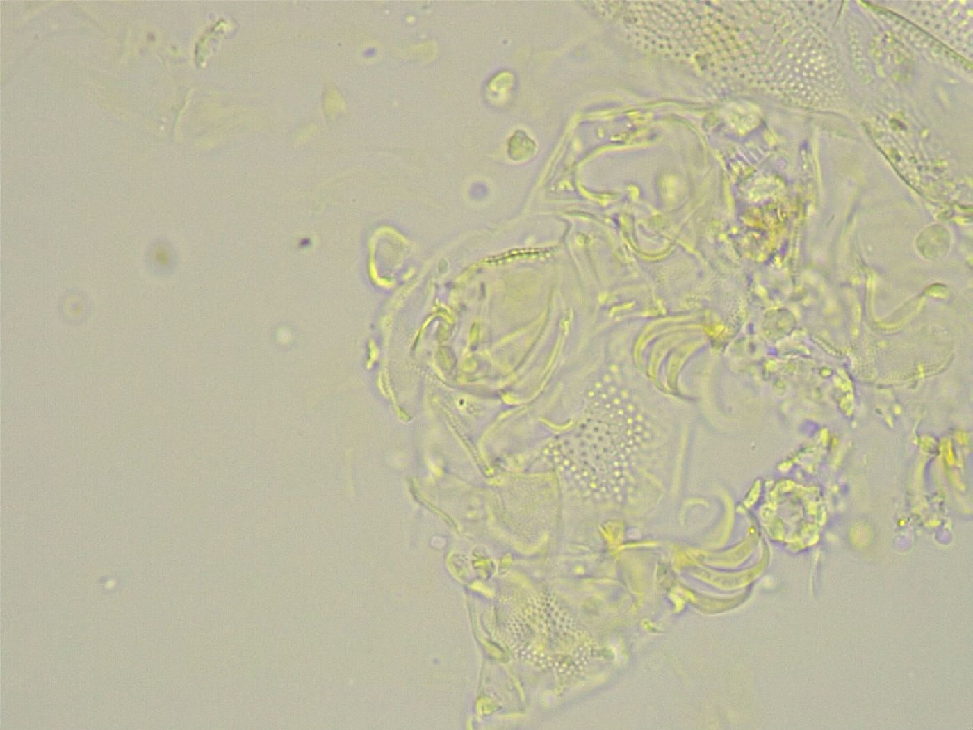 Echiniscus becki image