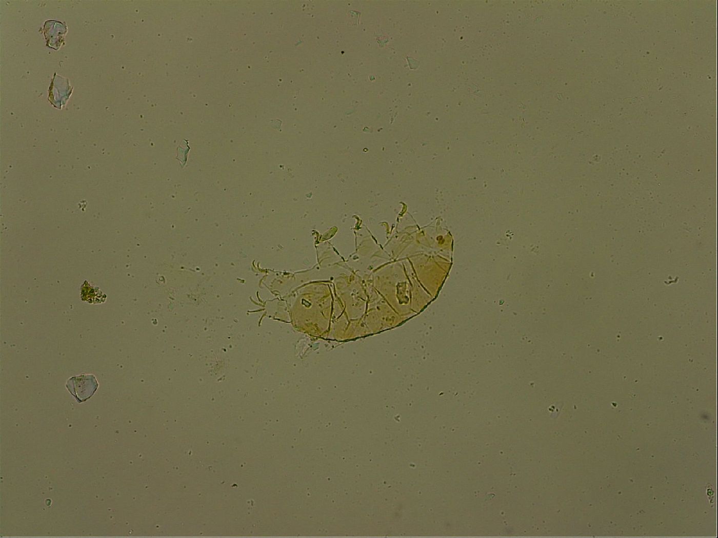 Echiniscus becki image