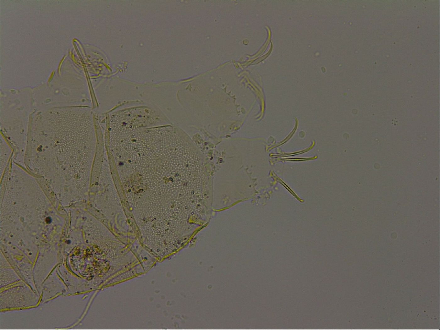 Echiniscus becki image