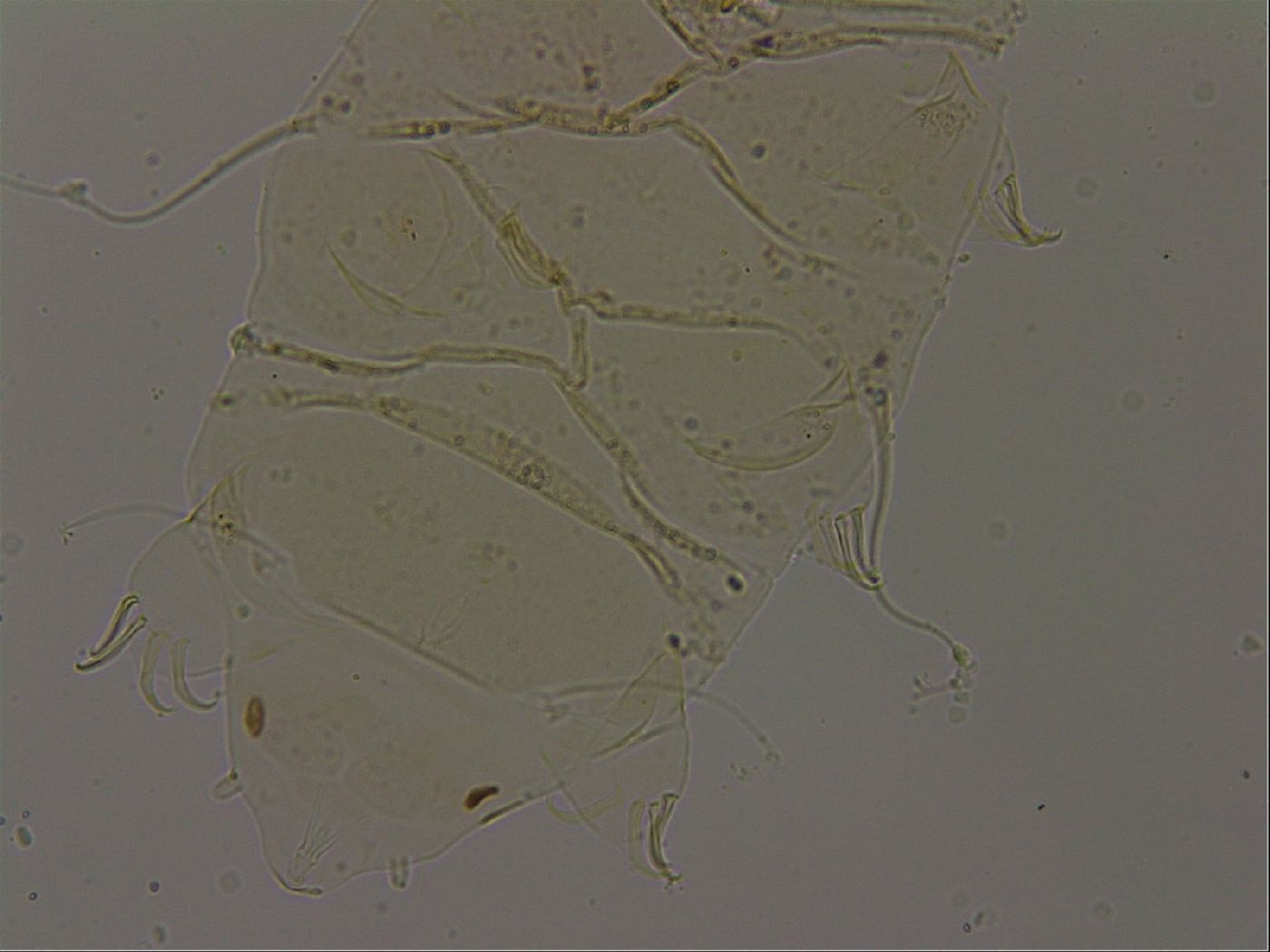Echiniscus becki image