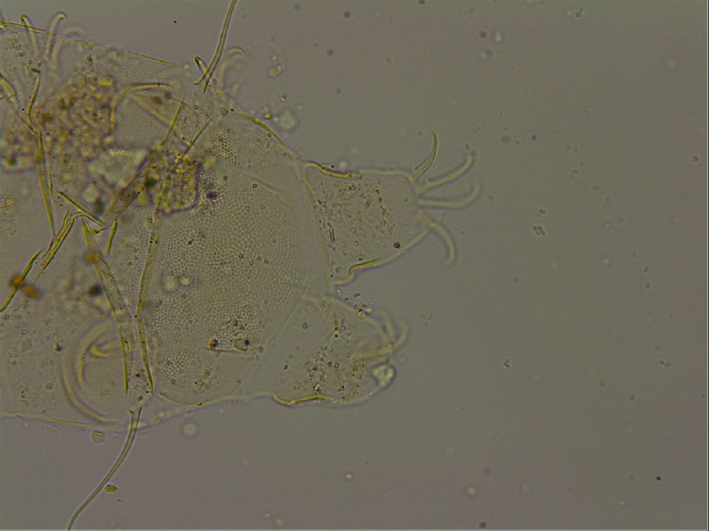 Echiniscus becki image