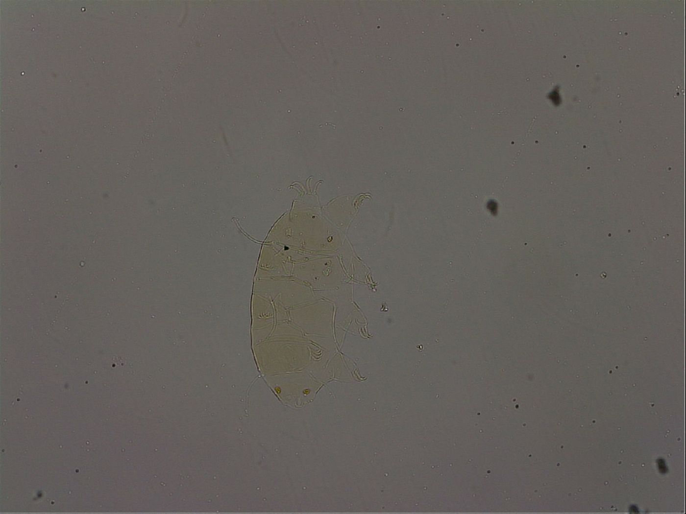 Echiniscus becki image