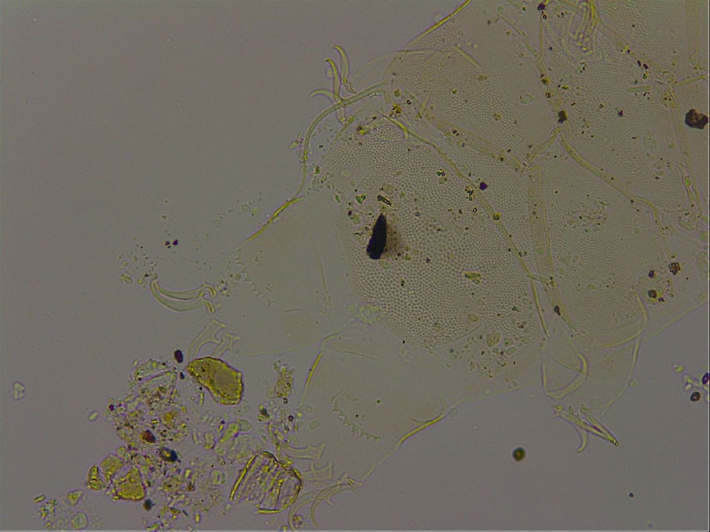 Echiniscus becki image