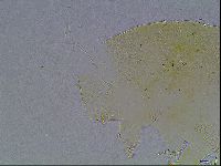 Echiniscus bigranulatus image