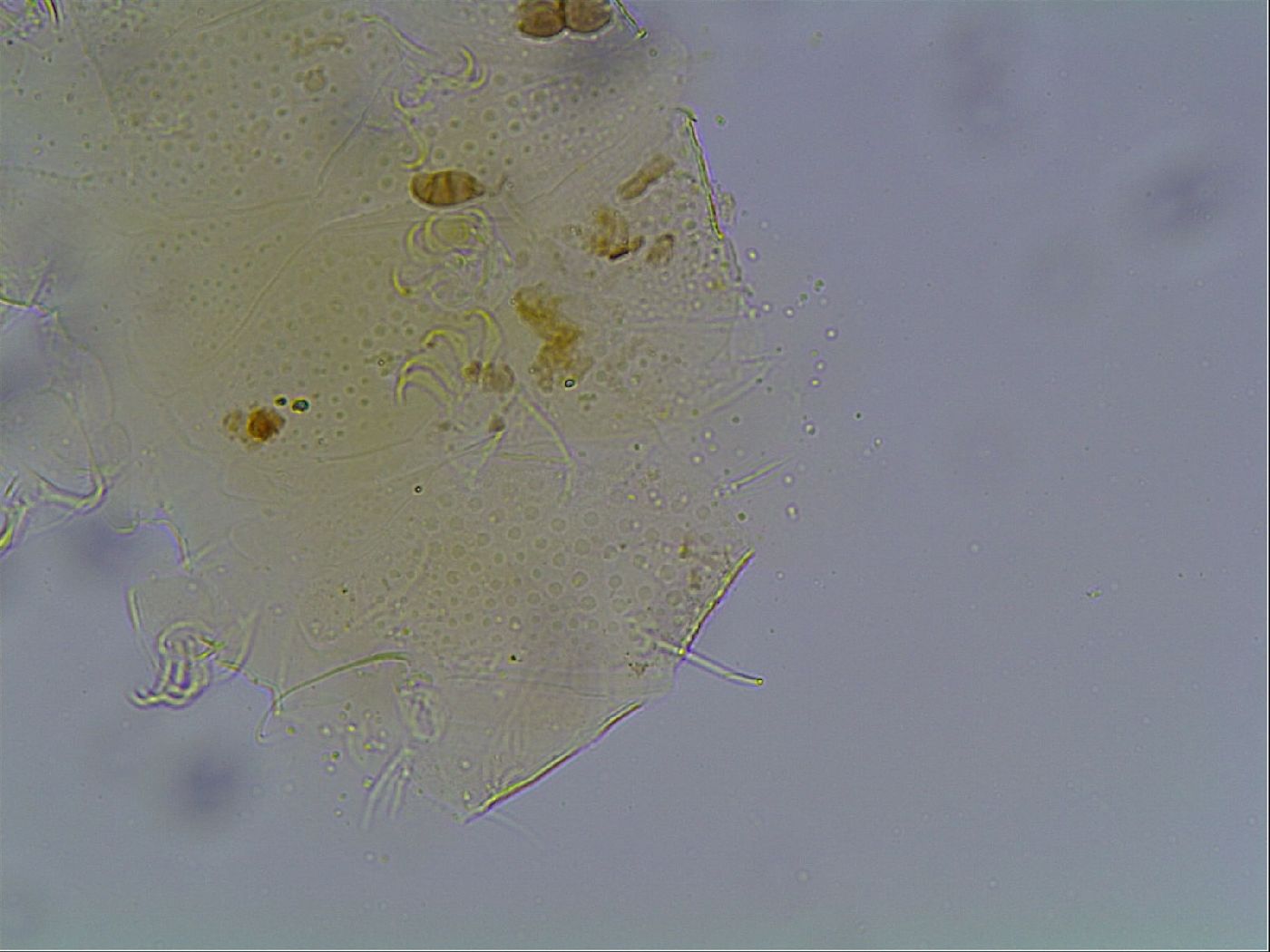 Echiniscus bigranulatus image