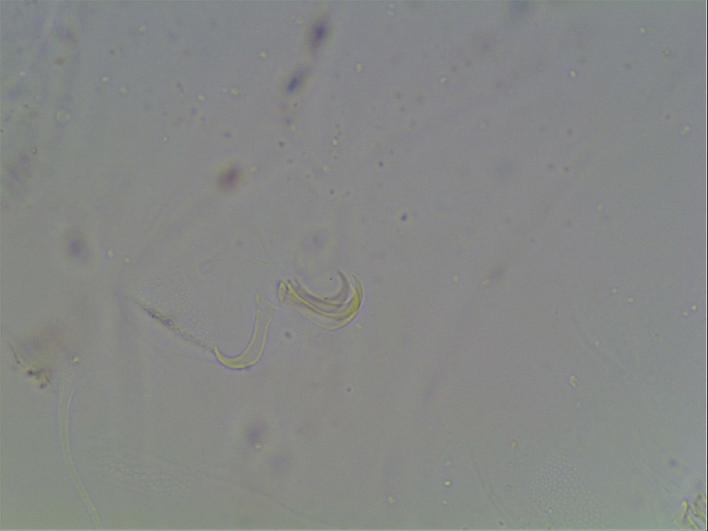 Echiniscus blumi image