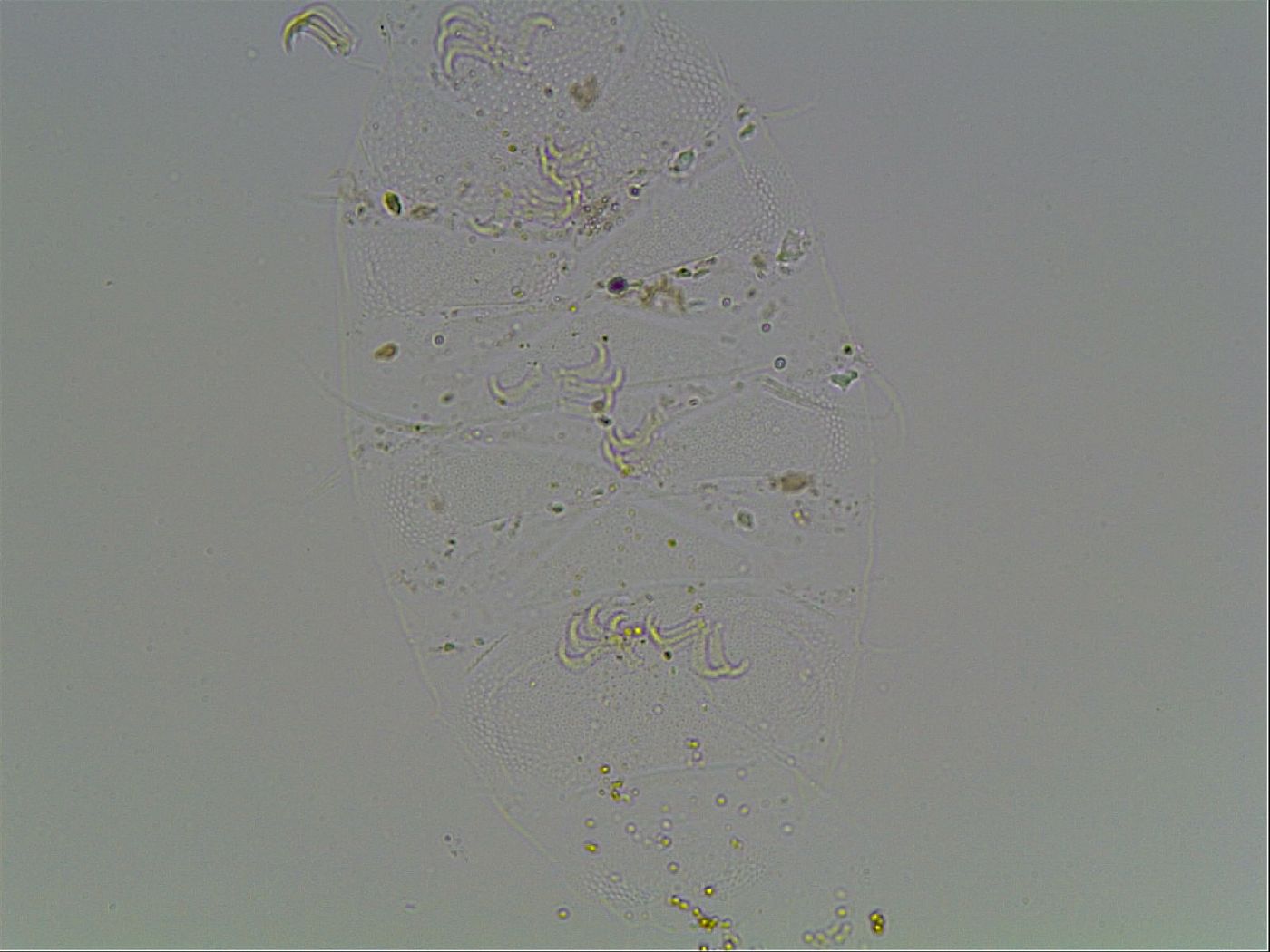 Echiniscus blumi image