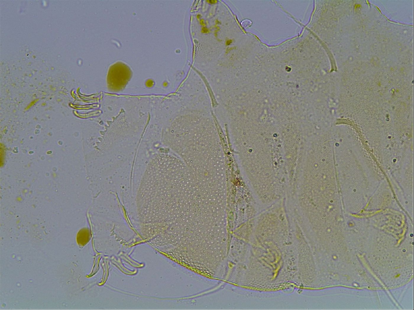 Echiniscus blumi image