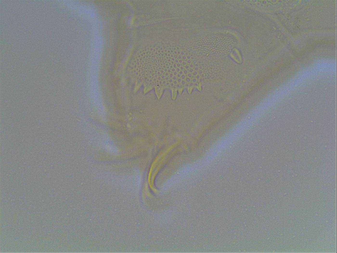 Echiniscus canadensis image