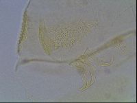 Echiniscus canadensis image