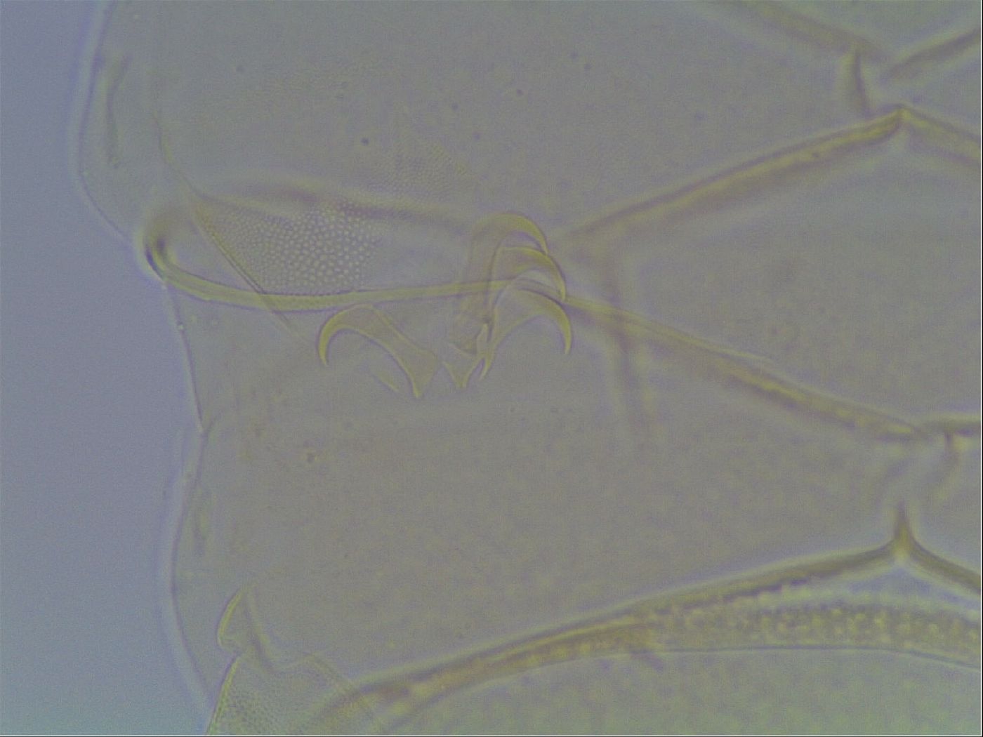 Echiniscus horningi image