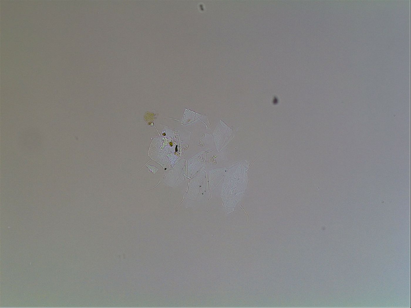 Echiniscus horningi image