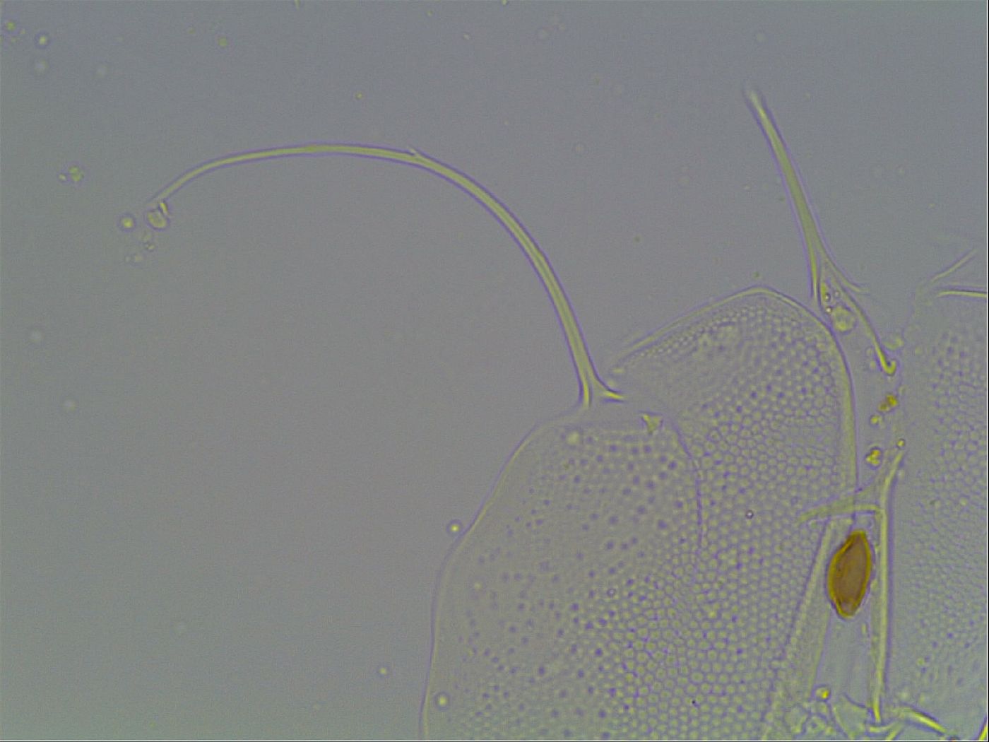 Echiniscus horningi image