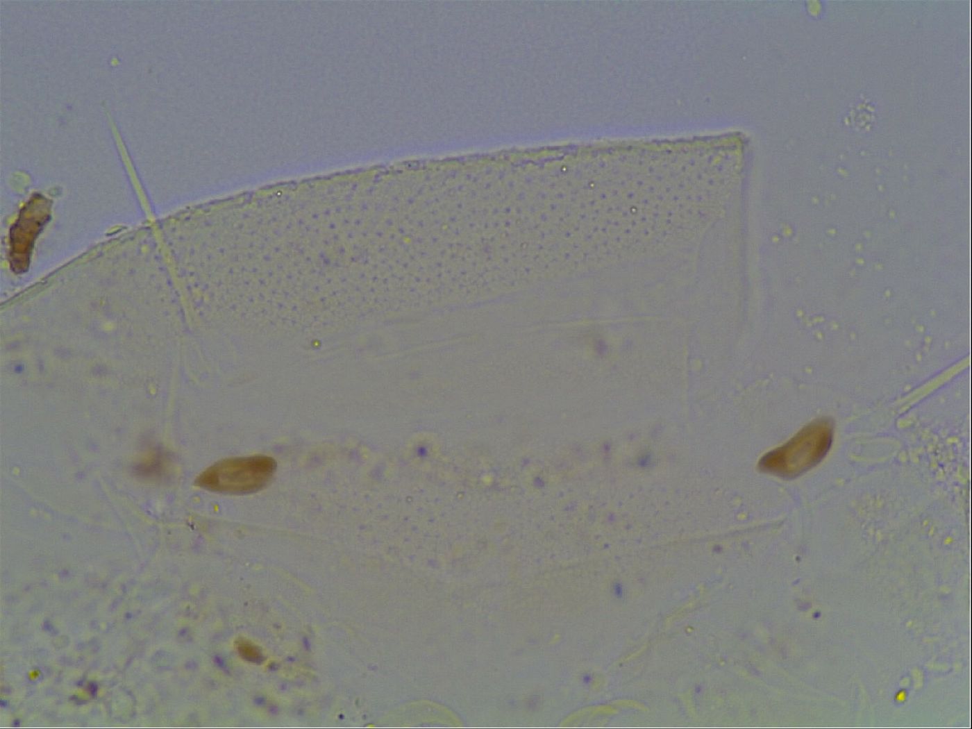 Echiniscus knowltoni image
