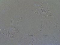 Testechiniscus laterculus image