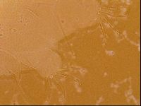 Testechiniscus laterculus image