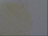 Testechiniscus laterculus image