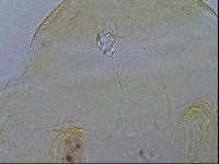 Testechiniscus laterculus image