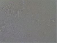 Testechiniscus laterculus image
