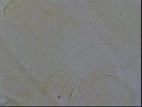 Testechiniscus laterculus image