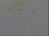 Testechiniscus laterculus image