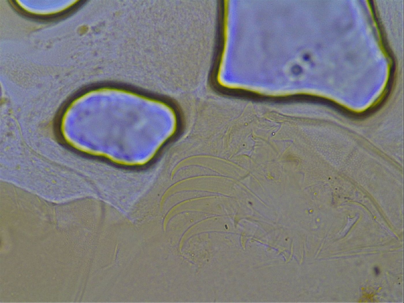 Testechiniscus laterculus image