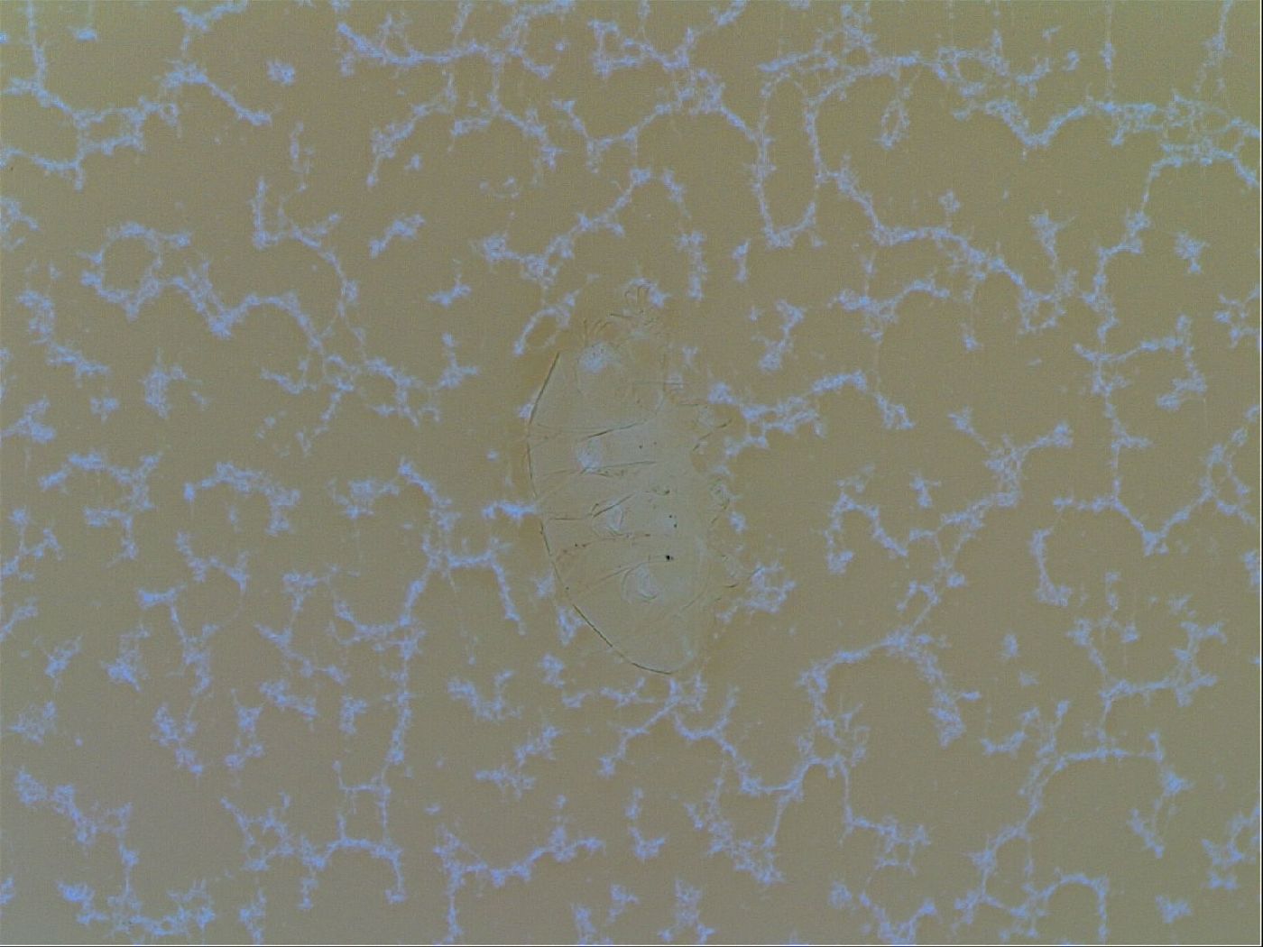 Testechiniscus laterculus image
