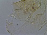 Testechiniscus laterculus image